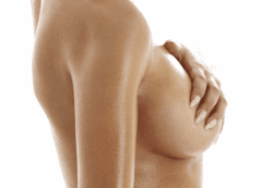 Breast Augmentation