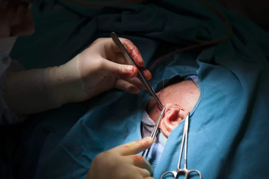close. up of doctor operating on ear